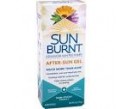 sunburnt advanced..