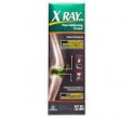 xray dol topical ..